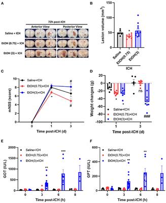 Moderate Ethanol Pre-treatment Mitigates ICH-Induced Injury via ER Stress Modulation in Rats